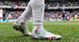 Malik Tillman’s bloody sock game rockets into US World Cup history